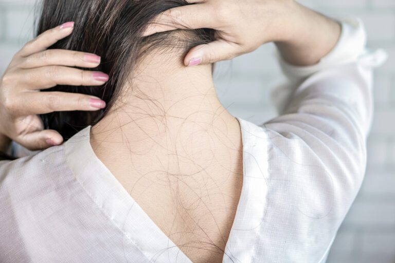 Por que as mulheres estão perdendo cada vez mais cabelo?